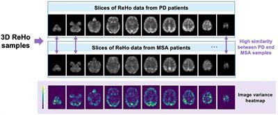 3D-CAM: a novel context-aware feature extraction framework for neurological disease classification